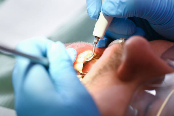 Best Emergency Cosmetic Dentistry in Central Square, NY