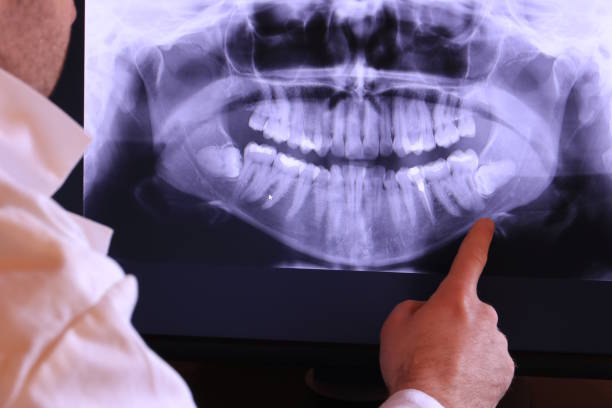 Best Pediatric Emergency Dentist in Central Square, NY