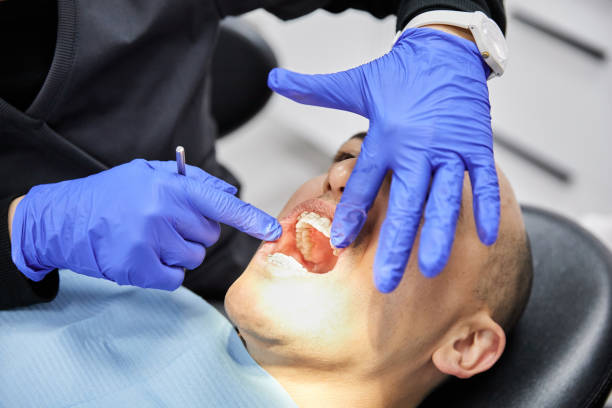 Best Emergency Dentist for Knocked-Out Tooth in Central Square, NY