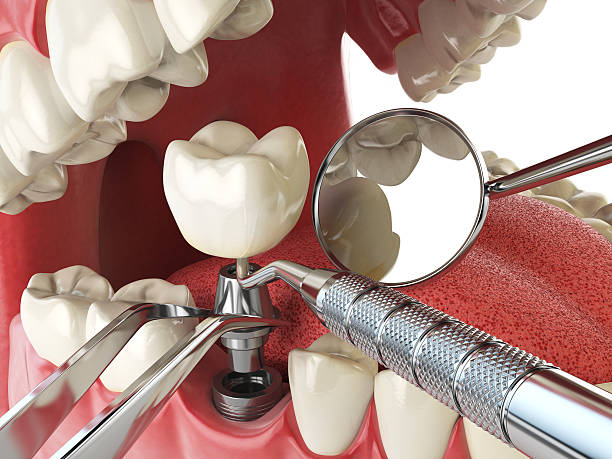 Best Orthodontic Emergency Dentist in Central Square, NY